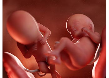 Echographie 3D montrant de vrais jumeaux vers 26 semaines de grossesse.